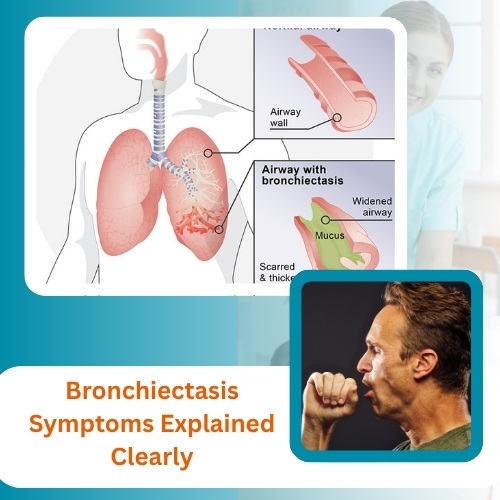 Bronchiectasis Symptoms Explained Clearly: What to Watch For and Why It Matters - Herbs Solutions By Nature Blog