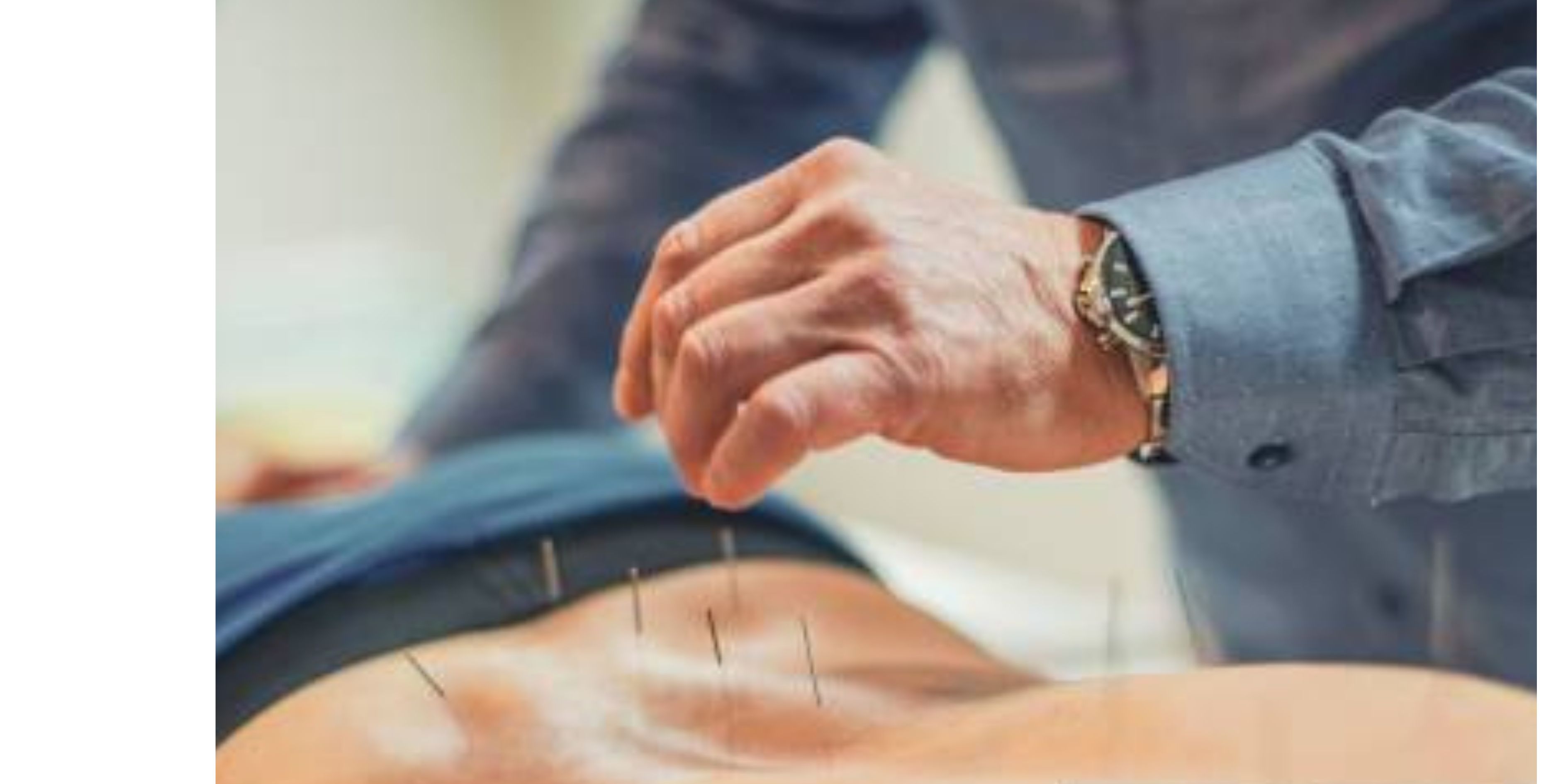 Say Goodbye to Sciatica Pain with Acupuncture Techniques